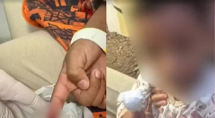 Menino de 6 anos é atacado por piranhas em rio na Bahia
