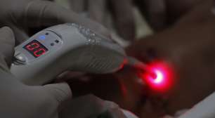 Conheça os benefícios da laserterapia