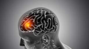 Aneurisma cerebral é hereditário? Entenda os fatores de risco