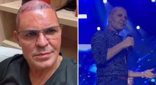 Eduardo Costa faz show careca: 'Não estou preocupado com minha aparência'