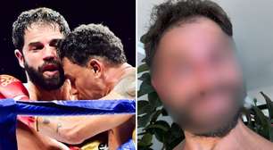 Duda Nagle surge com o rosto 'desconfigurado' após luta com Popó: 'Mão de pedra'