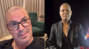 Eduardo Costa revela motivo inusitado da queda de seu cabelo: 'Usei muita'