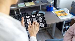 Pesquisadores encontram novo método que pode reduzir tempo para diagnosticar tumores cerebrais