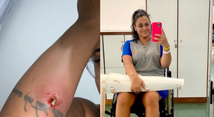 Mulher fica paraplégica após infecção causada por furúnculo: 'Chorei por ter conseguido ficar viva'