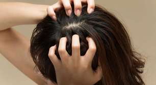 Acne no couro cabeludo: especialista explica como tratar