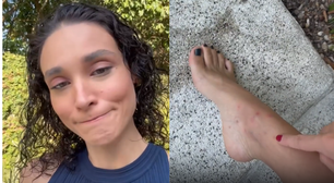 Débora Nascimento reclama de 22 picadas de mosquito ao tomar sol nua