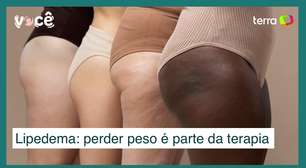 Lipedema: perda de peso é a terapia, mas não diminui inflamação das coxas