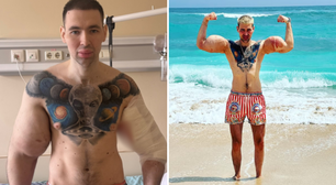 Influencer conhecido como 'Popeye Russo' é hospitalizado para 'retirar bíceps'