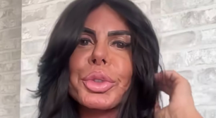 Gretchen ignora críticas e exibe novos procedimentos: 'Fininho'