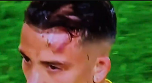 Enzo Fernandez crava as travas na testa de adversário colombiano em jogo da Argentina
