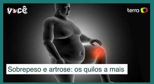 Sobrepeso e artrose: cada quilo adicional aumenta 4 kg sobre os joelhos