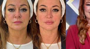 Antes e depois Nadine Gonçalves: mãe de Neymar paga R$ 25 mil em rejuvenescimento facial e resultado surpreende