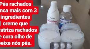 Dica caseira para fazer um creme para rachaduras dos pés que vai surpreender você