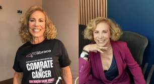 Arlete Salles relembra casamento conturbado com ator da Globo: "Foi horrível"