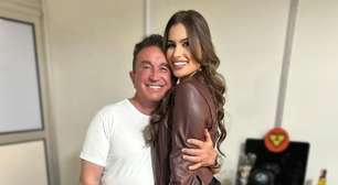 Esposa de Amado Batista posta fotos antigas e diz se já fez plásticas: 'Me assustei'