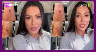 Gracyanne Barbosa relata acidente durante treino e desabafa sobre frustração