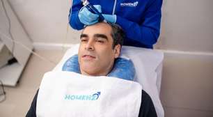 Transplante capilar: mitos e verdades sobre o procedimento