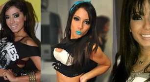 Poucos sabem, mas Anitta já havia feito duas plásticas antes de explodir com 'Show das Poderosas': 'Sempre fui ansiosa'