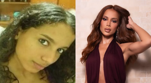 Mudou muito? Saiba quantos procedimentos estéticos Anitta já fez