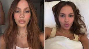 Anitta fez o que no rosto? Especialista dá palpites
