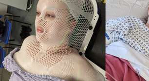 Mulher grávida de 44 anos achou que tinha distendido um músculo na aula de ioga, mas caroço na perna se revelou um câncer raro e incurável
