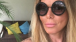 Ex-modelo é internada após ferir familiares e pessoas próximas