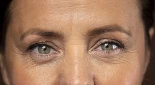 Blefaroplastia: a cirurgia nas pálpebras que rejuvenesce o olhar