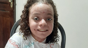 Jovem tem doença rara que causa bolhas na pele e está sem receber curativos desde outubro