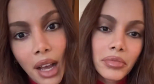 Sem 'pé na cova', sem cara 'desfigurada': Anitta fala pela 1ª vez sobre nova plástica no rosto. 'Eu sempre fiz, mas'