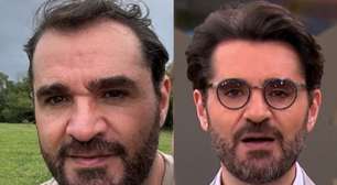 Ex-calvo, apresentador exibe resultado do implante e abandona o 'shape' musculoso