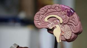 Mulher morre após aneurisma cerebral romper durante orgasmo