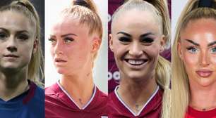 Antes e depois de Alisha Lehmann: jogadora de futebol mais seguida do mundo passou por transformação polêmica no rosto e 30 fotos vão te chocar