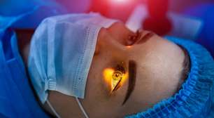 Cirurgia PRK corrige casos de miopia e astigmatismo
