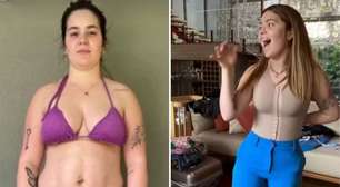 'Mommy Makeover': Médico explica 'combo' de cirurgias feitas por Viih Tube para eliminar 15 kg