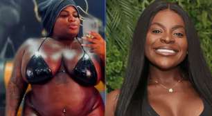 Com 69kg a menos, Jojo Todynho revela o antes e o depois real de sua cirurgia bariátrica