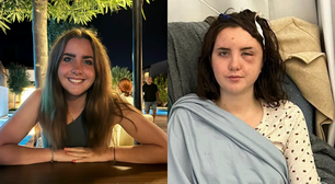 Jovem descobre tumor cerebral após achar que estava com insolação