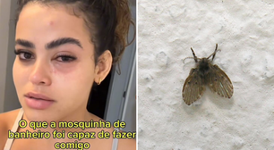 Jovem vai parar no médico após mosca entrar no olho: 'Desesperada'