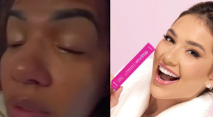Entrevista | Vítima de produto da WePink, cabeleireira desmente versão da marca e relata momentos de tensão após passar dias sem enxergar: 'Traumatizada'
