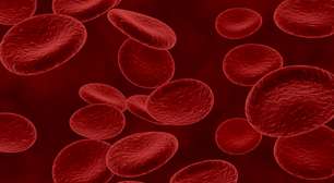 Mielodisplasia: doença silenciosa pode evoluir para leucemia