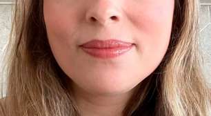 Médica detalha os sintomas da Síndrome Geniturinária da Menopausa