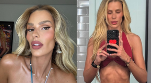 Yasmin Brunet abre o coração e desabafa após perder 20kg: 'Doença crônica'