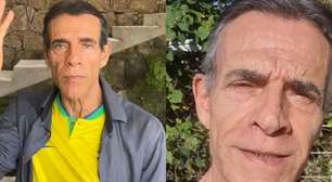 Antes e depois de Mário Gomes: ator de 'A Favorita' faz harmonização facial aos 72 anos e 'rejuvenesce 20'. Resultado impressiona!