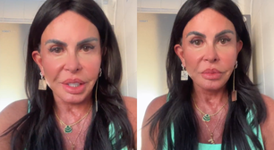 Gretchen passa por mais uma harmonização facial e apresenta novo rosto