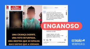 Foto de menino que teve doença agravada pela fome é usada para minimizar crise em Gaza