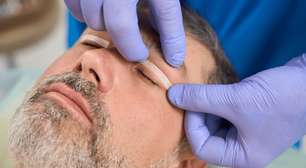 Blefaroplastia segura previne complicações graves