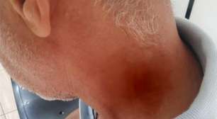 Homem preso por bater em bombeiro diz ter ouvido insultos racistas, em Rio Verde