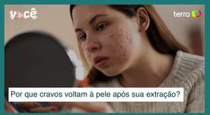 Cravos são invencíveis? Por que retornam à pele após extração?