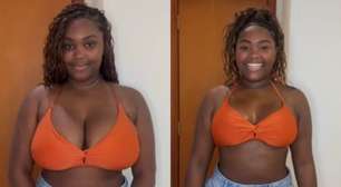Ex-BBB surpreende seguidores após cirurgia de redução de mamas; veja