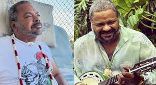 Famosos lamentam a morte de Arlindo Cruz: 'Legado eterno'