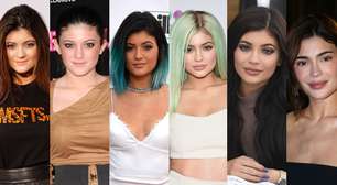 Antes e depois Kylie Jenner: em 65 fotos, veja a evolução da beleza da influencer após a fama e tudo sobre a sua jornada estética